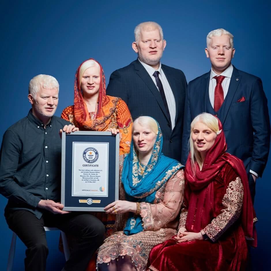 "Mindig összetartottunk" - a 6 albinizmussal született testvér bekerült a Guinness Rekordok Könyvébe