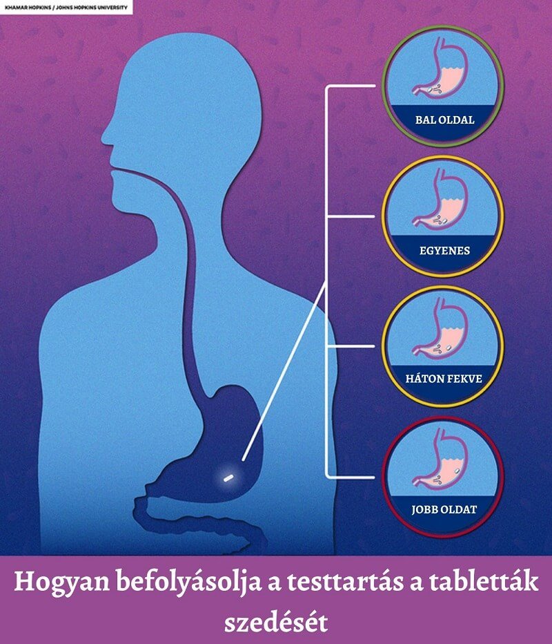 A szakemberek szerint mindvégig rosszul vetted be a gyógyszereid